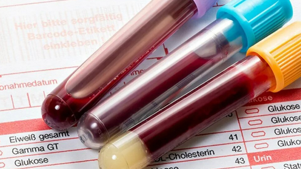 The Role of a Full STD Panel in Preventive Sexual Healthcare