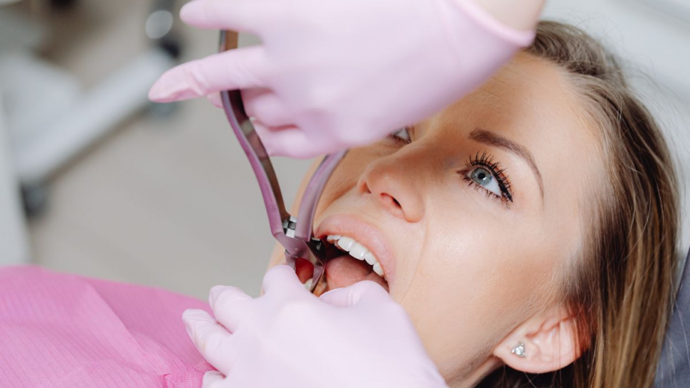 Questions to Ask Before Using a Dental Insurance Plan