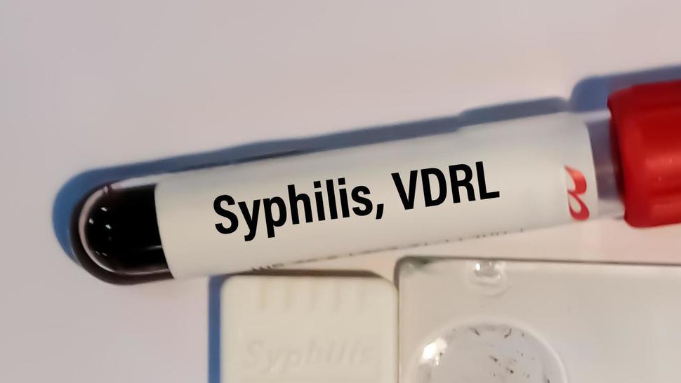 Syphilis Screening: Who Is Most at Risk and Why Testing Is Crucial