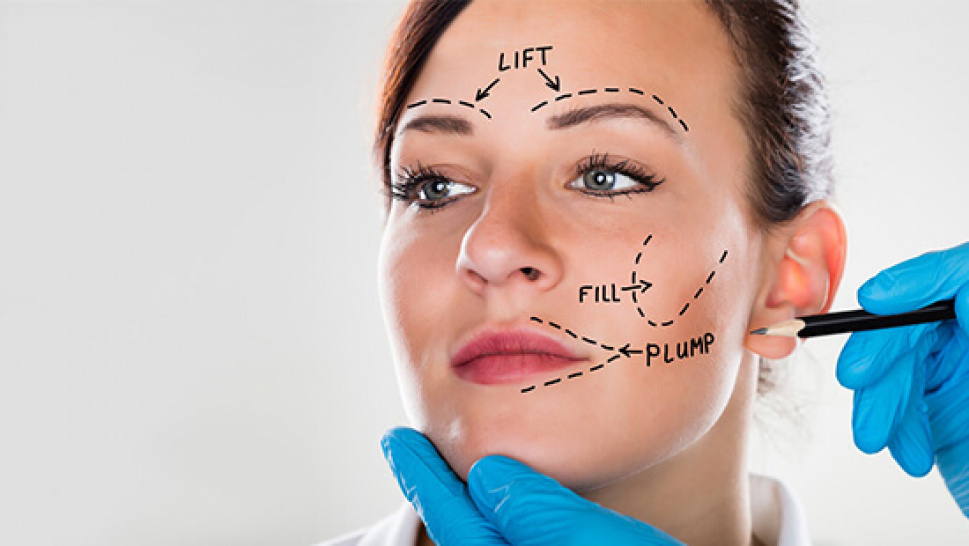 Facelift Surgery in Delhi - Dr Rajat Gupta