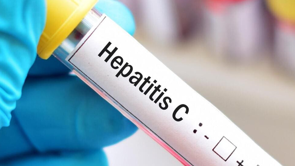 Hepatitis C Test and Chronic Infection: What You Need to Know