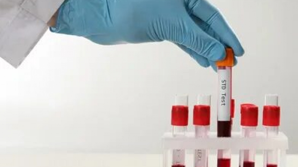 How to Interpret Chlamydia Test Results Correctly?