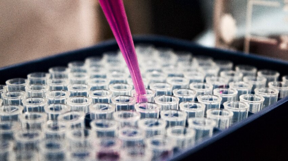 Apoptosis Assays: Unraveling the Mechanisms of Cell Death