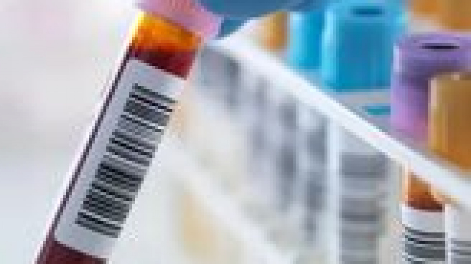 STD Test Symptoms vs No Symptoms: When to Get Checked