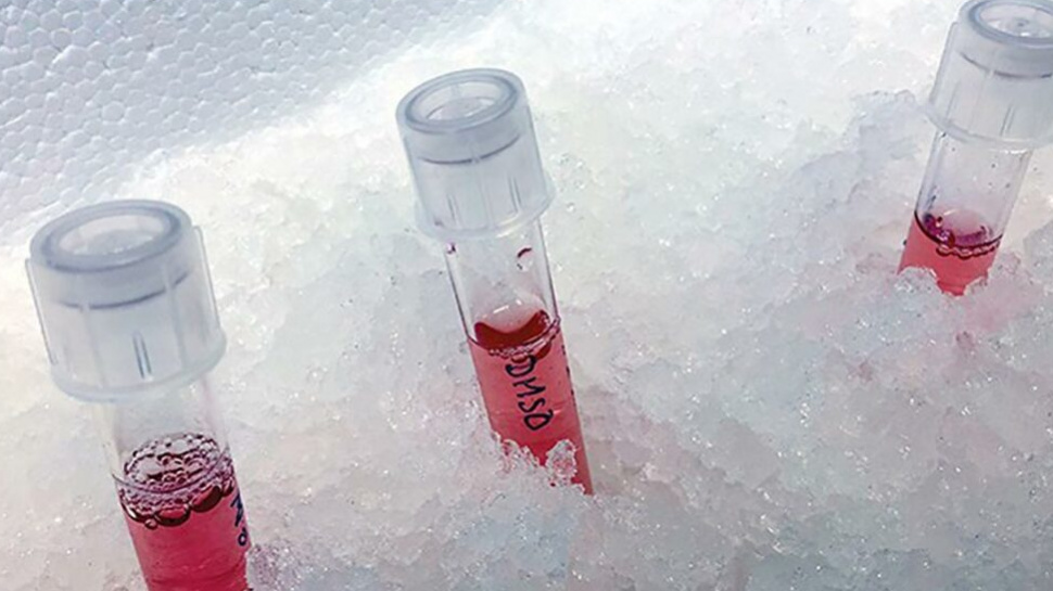 Signs You May Need a Hepatitis B Test Even Without Symptoms