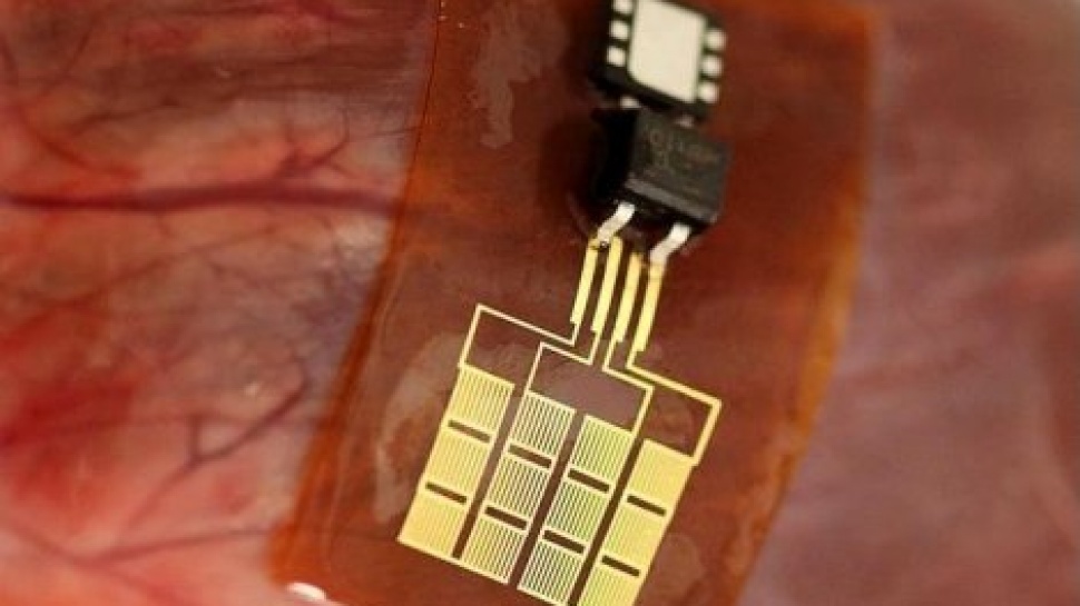 MC10 Biostamp - Lopinion - GLBrain.com