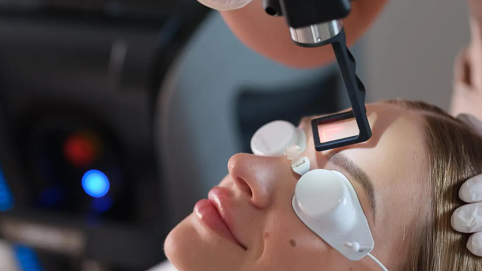How do clinics calculate fractional carbon laser treatment costs?