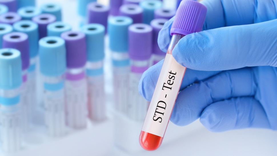 How Safe Are Sexual Health Testing Procedures?