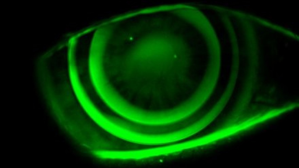 Night Vision Contact Lenses?